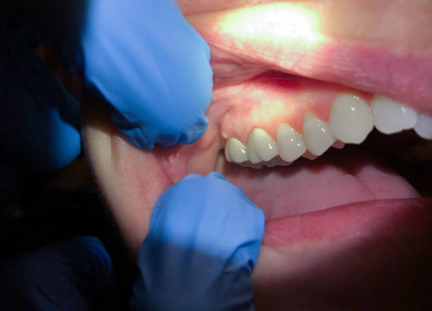 Professional Emergency Dental Service in FL
